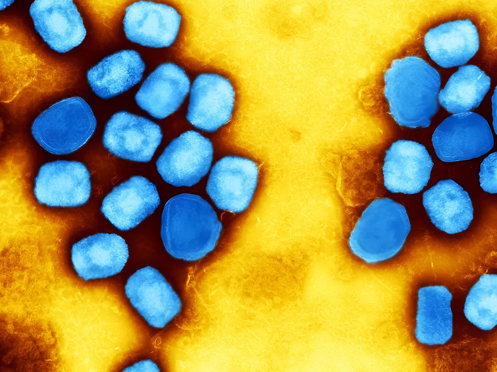 Blue mpox viral particles on a yellow background